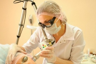 Wie wird das Verfahren zur fraktionierten Laser-Hautverjüngung durchgeführt 